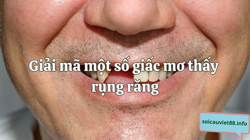 Giải mã một số giấc mơ thấy rụng răng