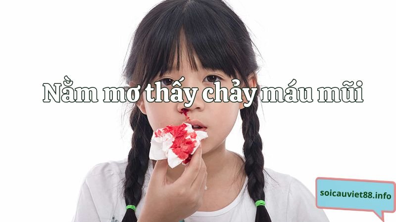 Mơ thấy chảy máu mũi