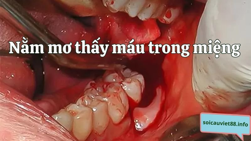 Nằm mơ thấy máu trong miệng