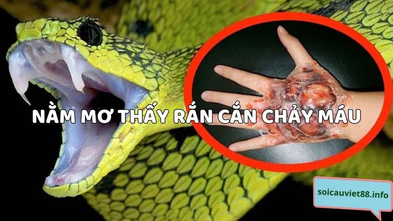 Nằm mơ thấy rắn cắn chảy máu