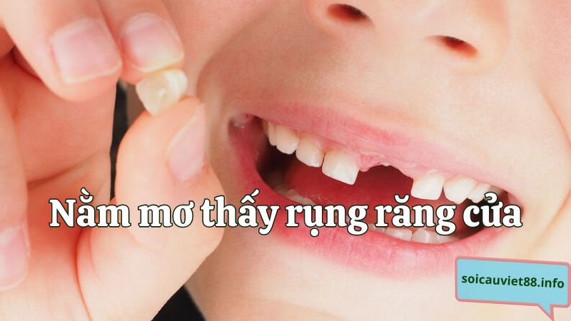 Nằm mơ thấy rụng răng cửa