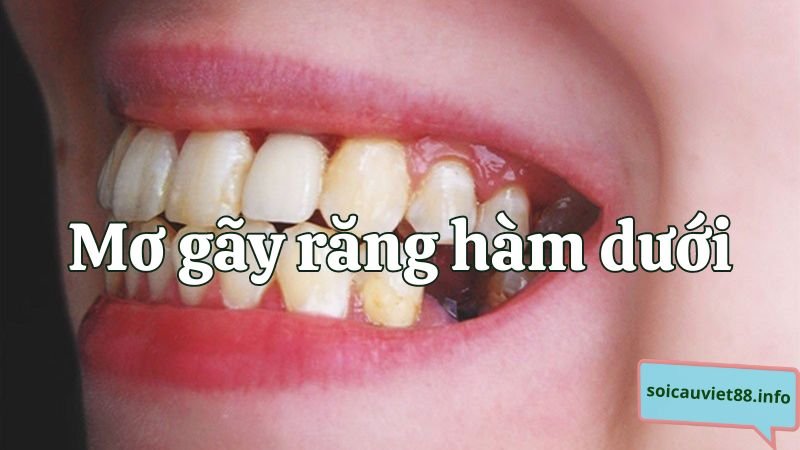 Mơ gãy răng hàm dưới